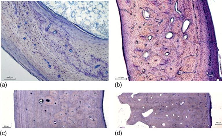 العظام الثانوية وحدات دقيقة في العظام 
