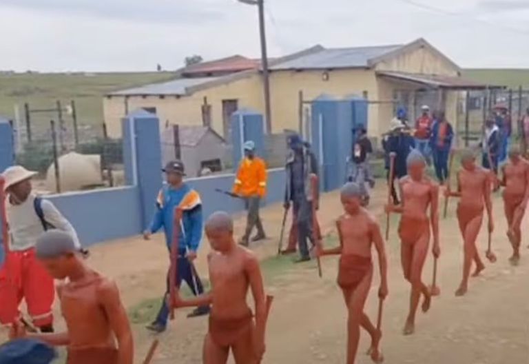 أدوات الختان- أرشيفية