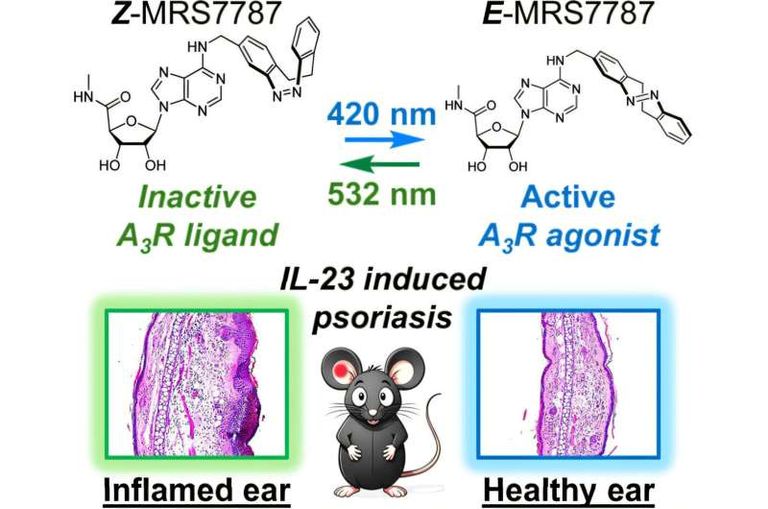 المركب «MRS7787» لعلاج الصدفية
