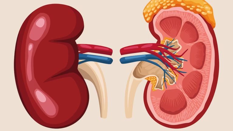 لقاح شخصي يعالج سرطان الكلى بنجاح