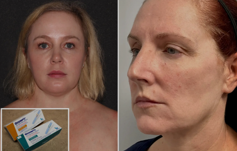 اتجاه جديد في عمليات التجميل