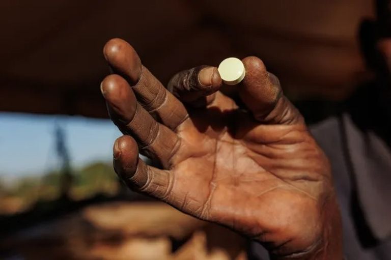 إنجاز طبي غير مسبوق في غينيا