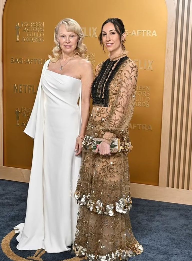 النجمة باميلا أندرسون