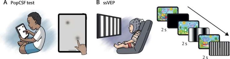 طرق قياس حدة البصر والإمكانات البصرية المستحثة. العين المعالجة بالعلاج الجيني أظهرت تحسنا في إدراك الضوء
