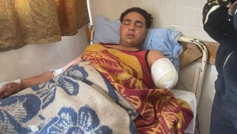 عامل السيرك المصاب