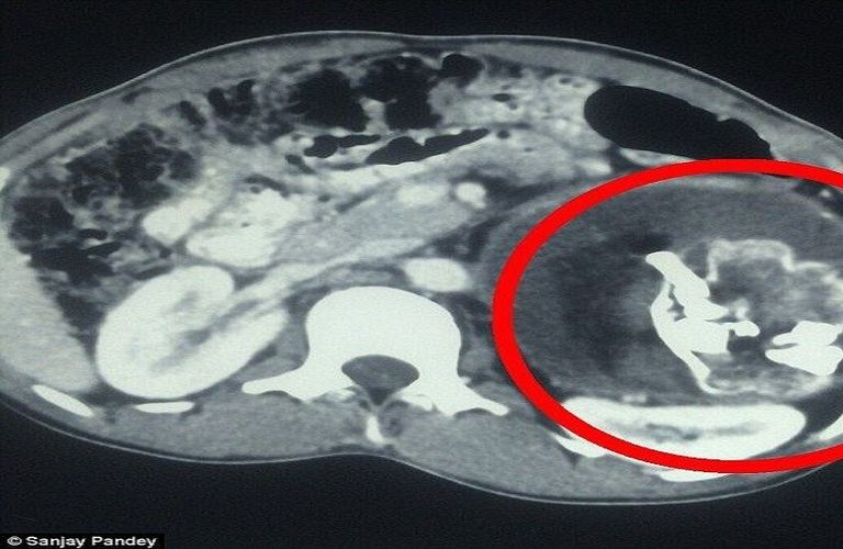 رضيع- أرشيفية