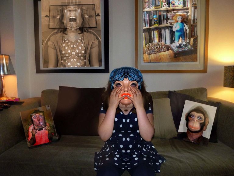 أغلب المصابين بمتلازمة أليس في بلاد العجائب من الأطفال