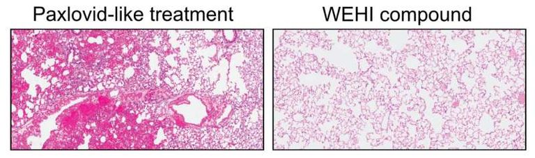 الدواء الجديد يستهدف لأول مره بروتين "PLpro " بالفيروس