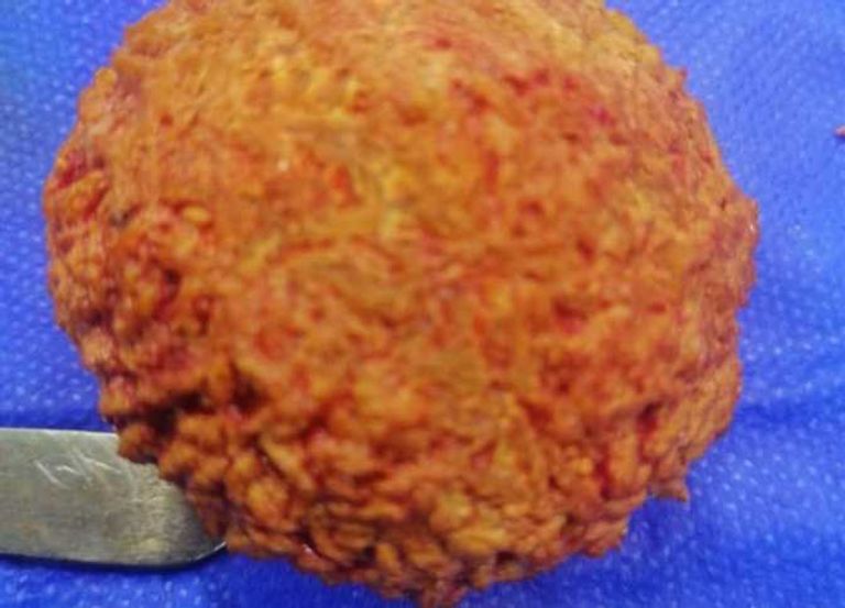 مريض في غرفة العمليات - أرشيفية 