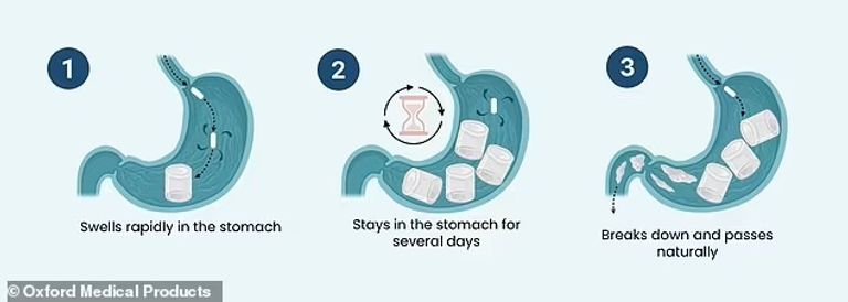 آلية عمل الكبسولة التي تمتص الماء ثم تتمدد في المعدة لتبقى عدة ساعات قبل أنا يتخلص منها الجسم