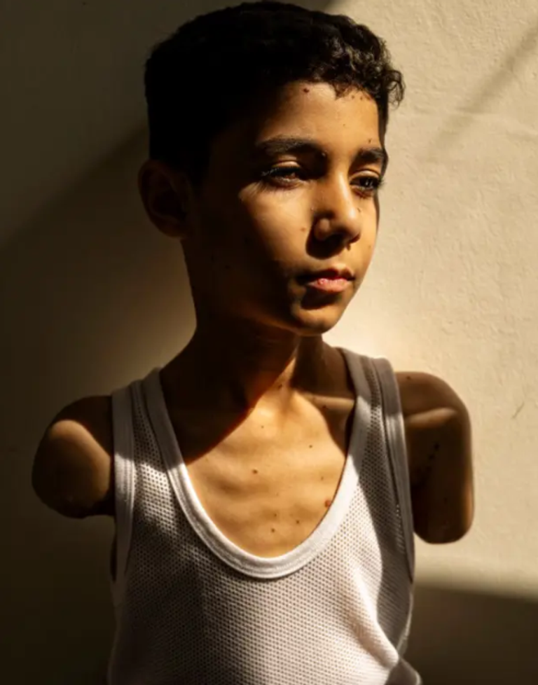 قطاع غزة بعد الدمار