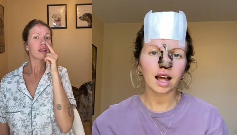 امرأة تحتفظ بكلبها رغم هجومه العنيف عليها امرأة تحتفظ بكلبها رغم هجومه العنيف عليها