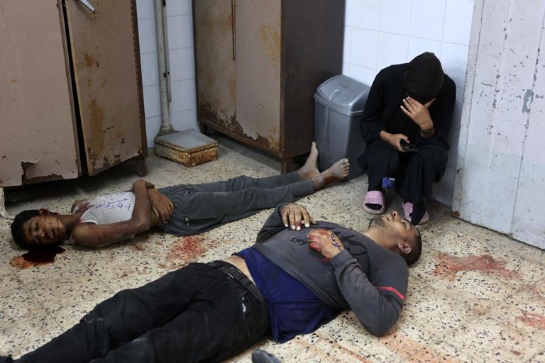 المجاعة في غزة وصلت مستويات مقلقة