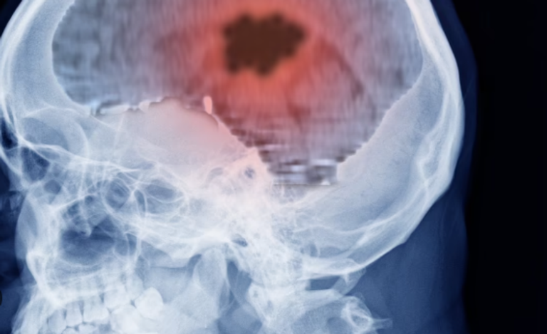 الطبيب "Medifectious" شرح في فيديو تفاصيل الاختبار