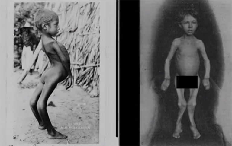 البيئة الفضائية ستحدث تأثيرات كبيرة على الجسم البشري حال الولادة في الفضاء