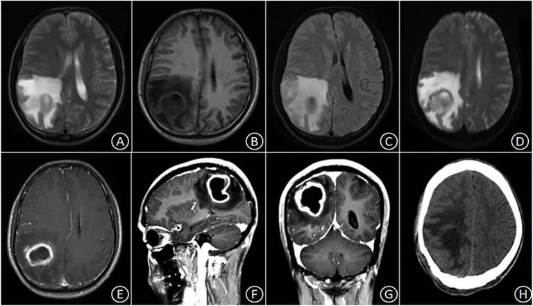 مريض في الرأس "تعبيرية" 