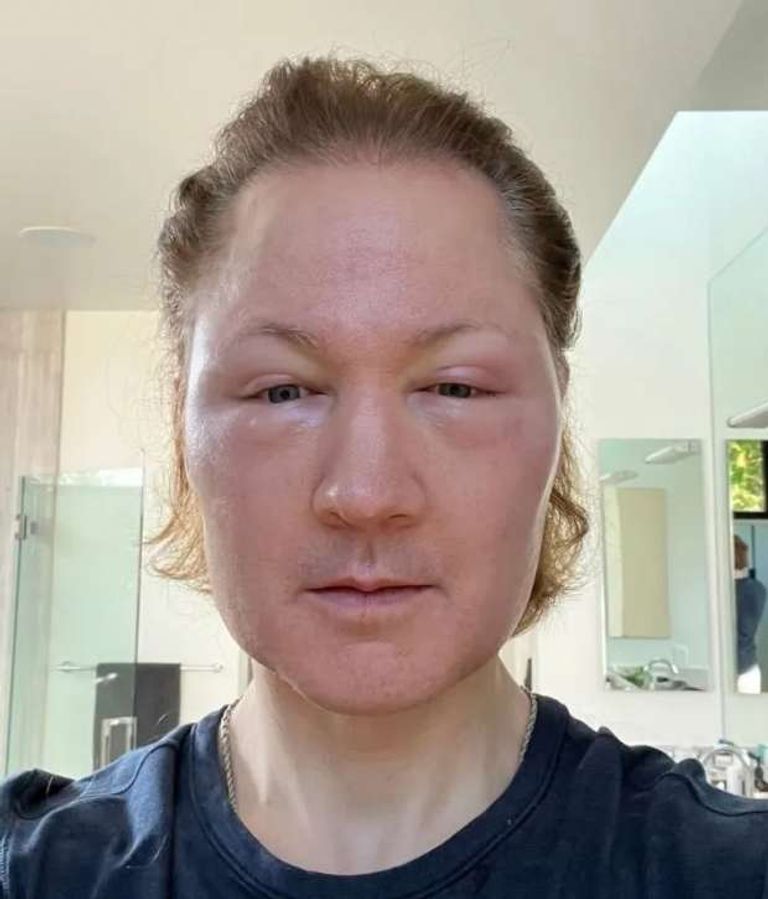 الملياردير الأمريكي بريان جونسون