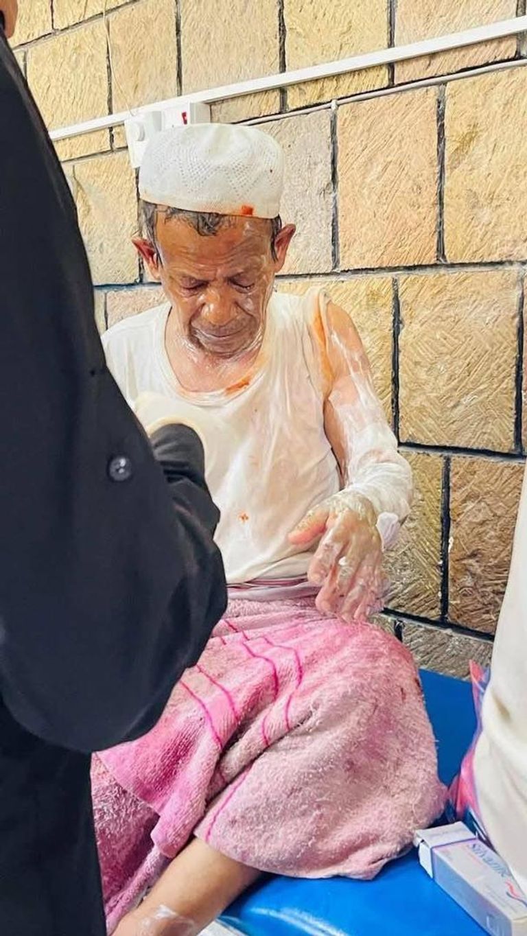 شهادة على انتهاكات الحوثيين في اليمن شهادة على انتهاكات الحوثيين في اليمن