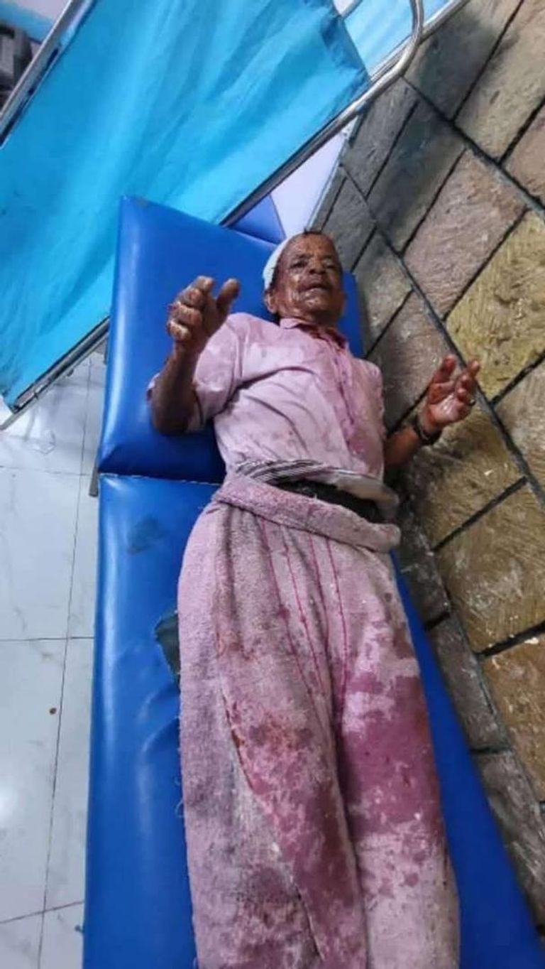 شهادة على انتهاكات الحوثيين في اليمن