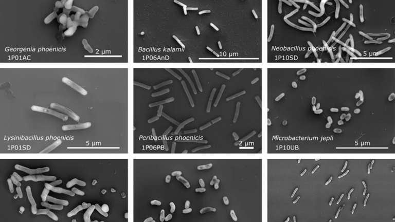 أنواع من البكتريا مجهولة