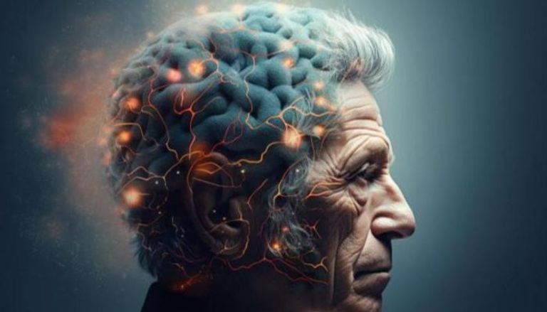 ألزهايمر يؤثر على 10% ممن تجاوزوا سن الخامسة والستين