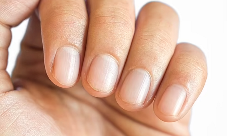 وجود الفتحة الصغيرة بين الأظافر مؤشر صحي وغيابها يدعو للقلق