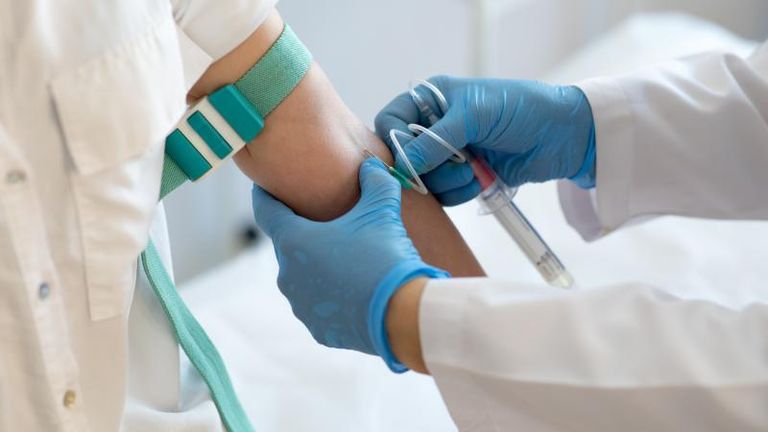 علاج متلازمة بهجت داء بهجت