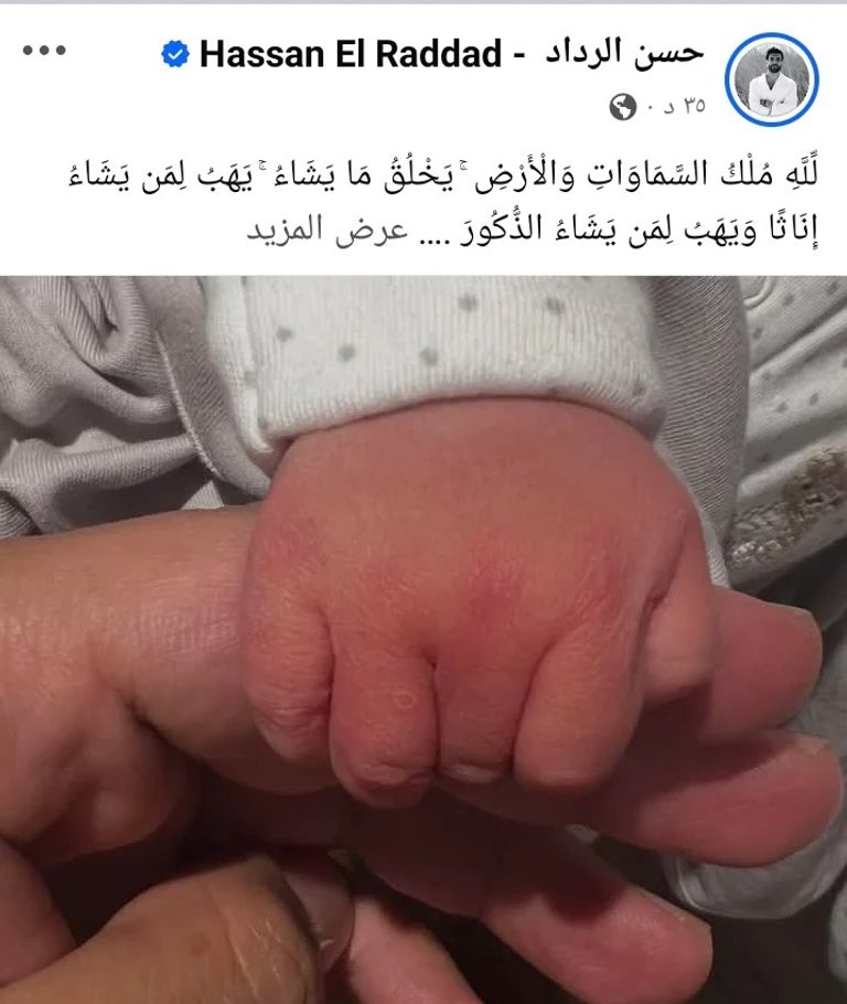 حسن الرداد وزوجته إيمي سمير غانم 