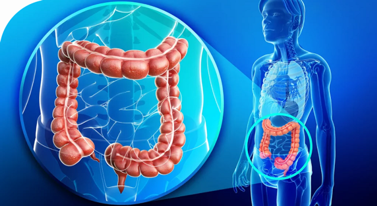 سرطان القولون يهدد الشباب أكثر من أي وقت مضى