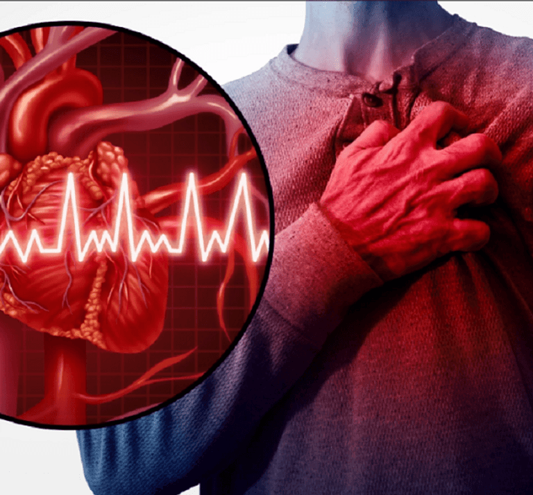 ارتفاع مقلق في عدد الوفيات الناتجة عن النوبات القلبية