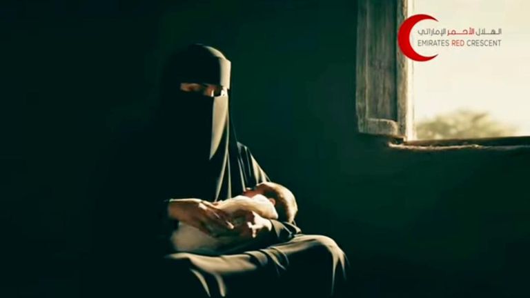 الأمل يعود لأسرة الطفل اليمني