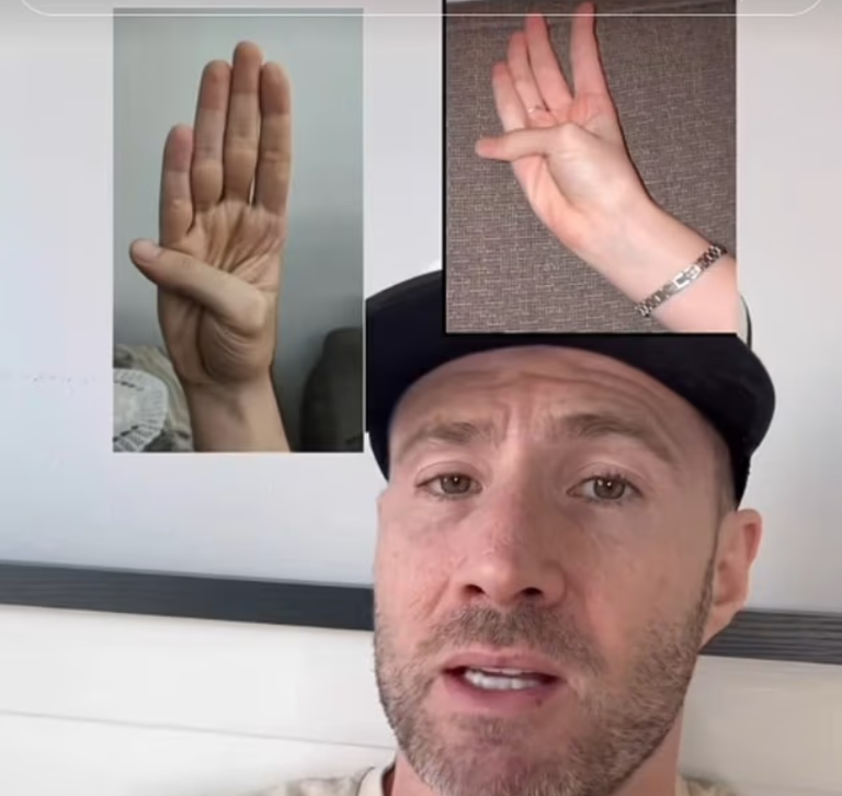 اختبار بسيط للإبهام يمكنه الكشف عن مشكلة قلبية «قنبلة موقوتة»