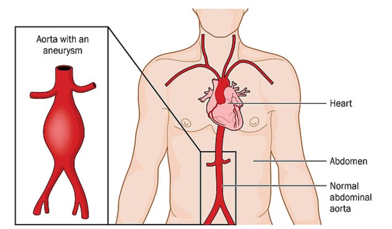 اختبار بسيط للإبهام يمكنه الكشف عن مشكلة قلبية «قنبلة موقوتة»