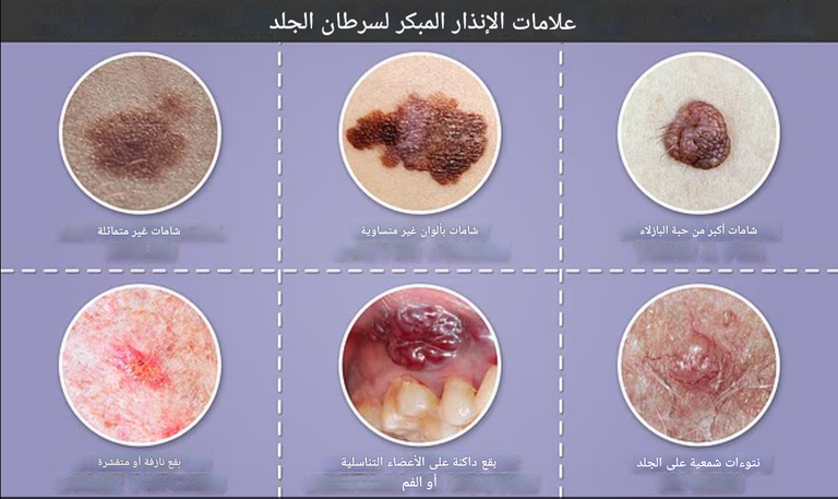 بعض الأدوية تجعل الجلد أكثر حساسية لأشعة الشمس