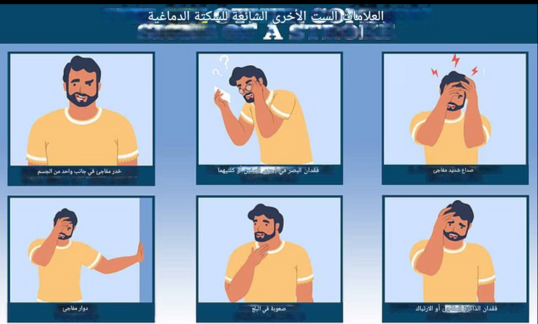 دواء تيكاجريلور (بريلينتا)