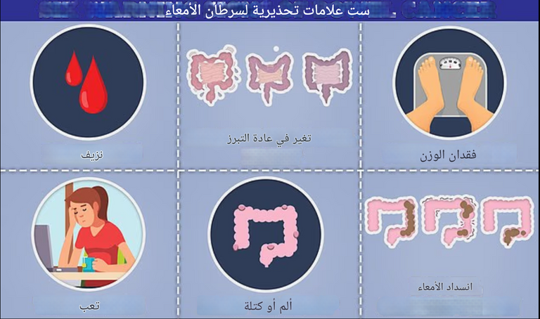 سرطان الأمعاء، أحد أكثر أنواع السرطان شيوعا في المملكة المتحدة