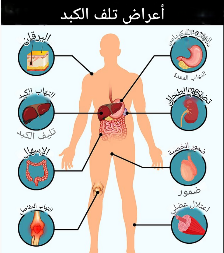 دواء 