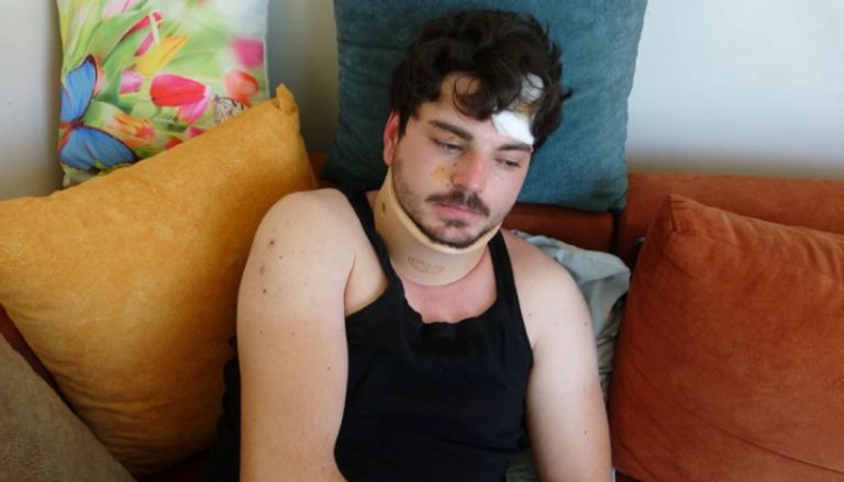 اعتداء عنيف على ممثل تركي شهير