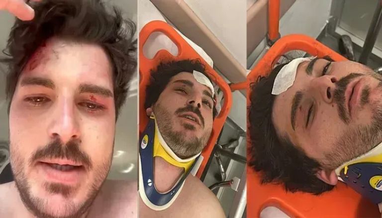 اعتداء عنيف على ممثل تركي شهير