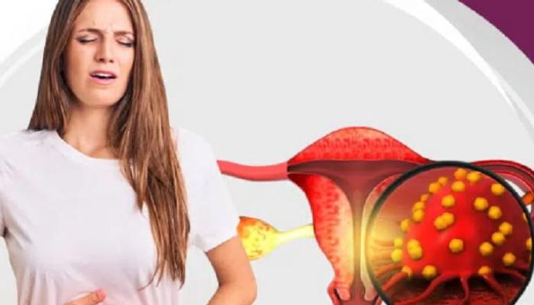 باحثون يحذرون من ارتفاع مقلق في معدلات الإصابة بسرطان الرحم