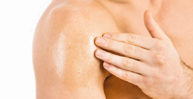 استخدام جل التستوستيرون قد يسبب تشوهات للأطفال