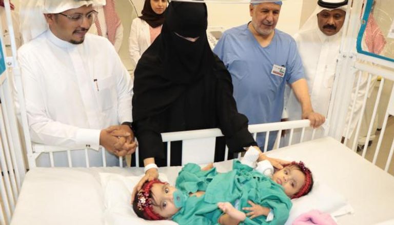 التوأم السيامي السعودي يارا ولارا