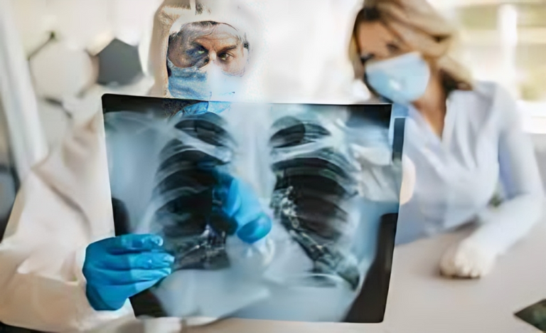 حمى الفيالقة