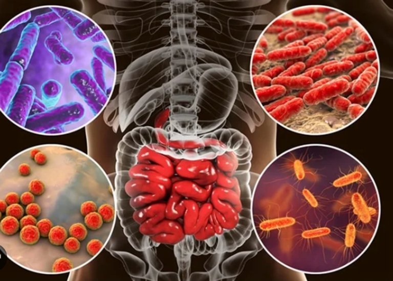 البكتيريا قد تزيد أو تقلل من خطر الإصابة بالأرق