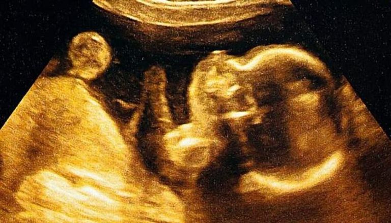 الذكاء الاصطناعي يتنبأ بموعد ولادة الطفل 