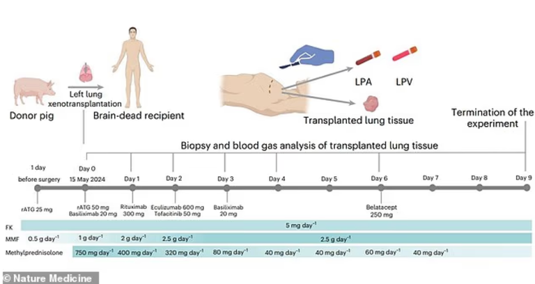 فريق طبي صيني أجرى أول عملية زراعة رئة خنزير معدلة وراثيًا في إنسان