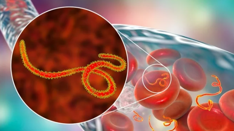 تفشٍّ جديد للإيبولا في الكونغو الديمقراطية