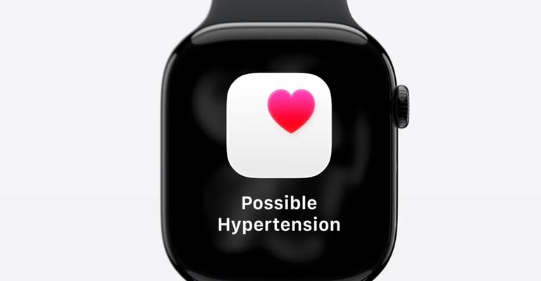 ساعة  Apple Watch Series 11 