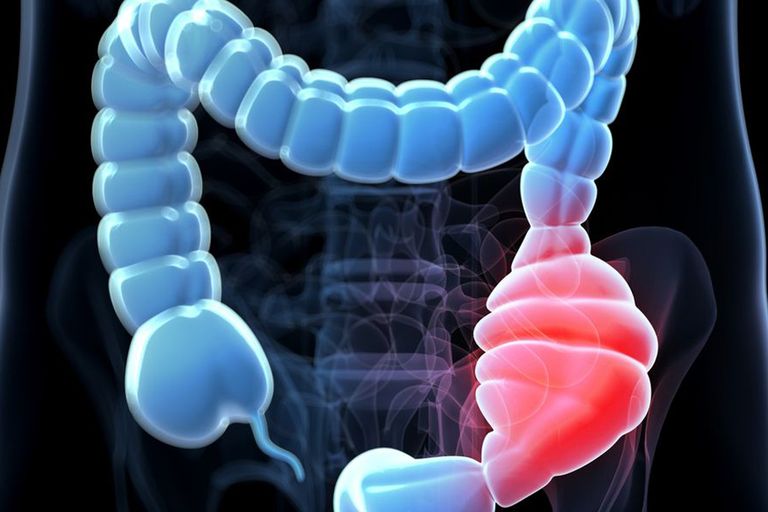 عادات صحية تقلل خطر الإصابة بالإمساك بنسبة 40%