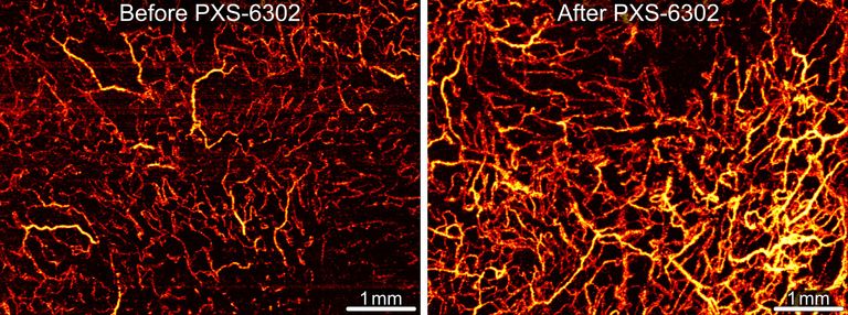 دواء موضعي يحقق نتائج مشجعة في علاج الندبات الجلدية